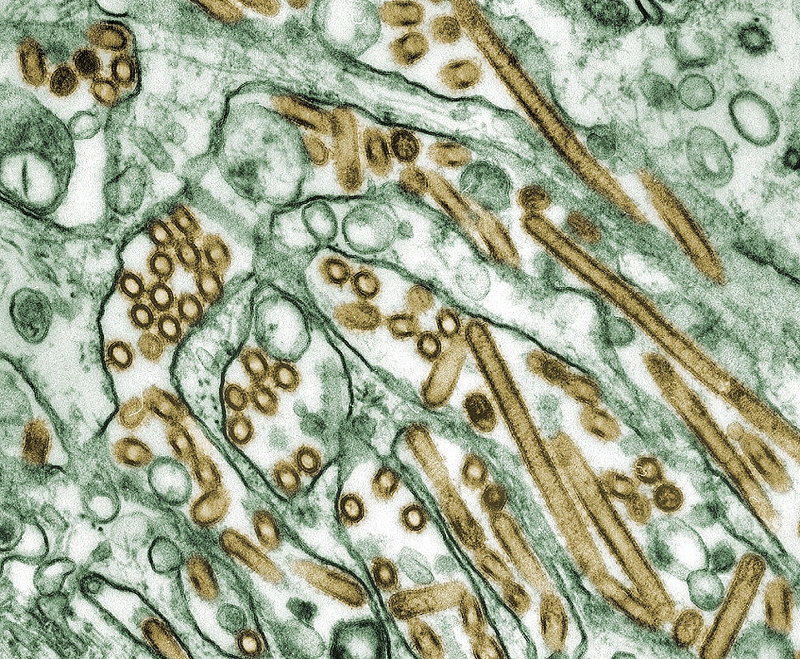 Micrografía electrónica colorizada de partículas del virus de la influenza.