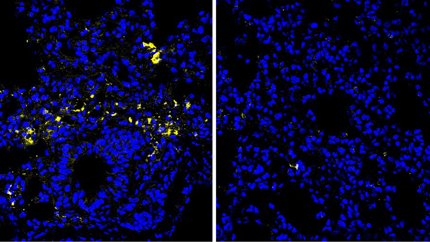 Comparación de tejido pulmonar de ratones con dietas de arginina alta y baja tras una infección viral.