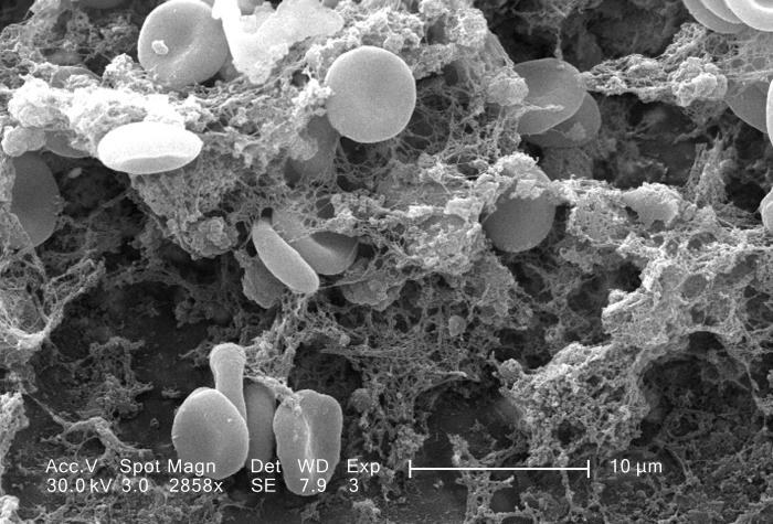 Micrografía electrónica de un coágulo sanguíneo.