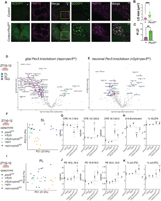 Figura del estudio que resume cambios diarios en importación peroxisomal, sueño y metabolismo de lípidos en el cerebro de Drosophila.