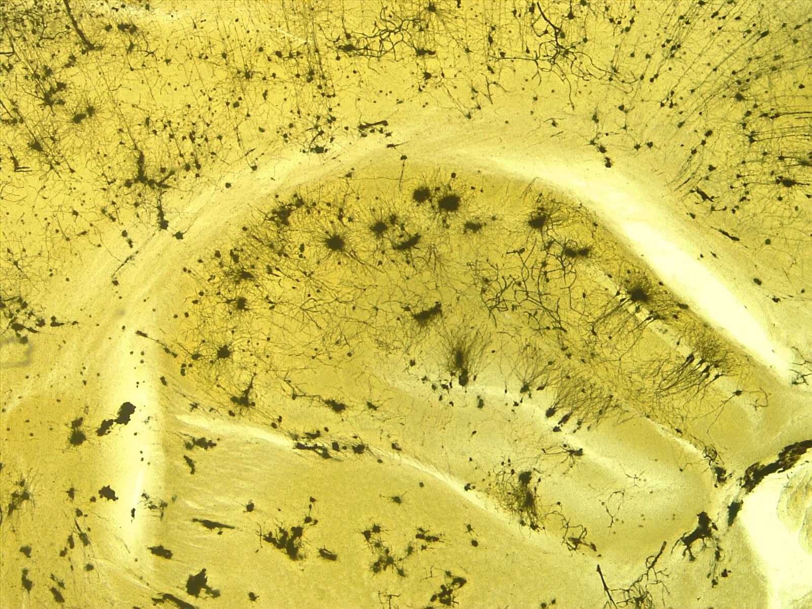 Neuronas teñidas observadas al microscopio.