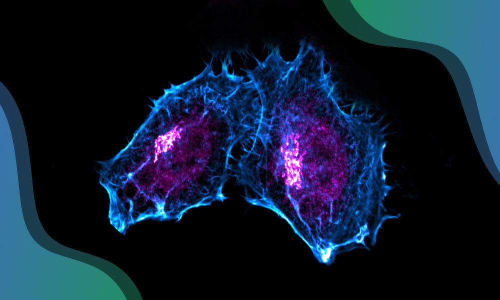 Micrografía de fluorescencia de células humanas donde se ve, en colores contrastados, la localización de proteínas vinculadas al aparato de Golgi y al núcleo.