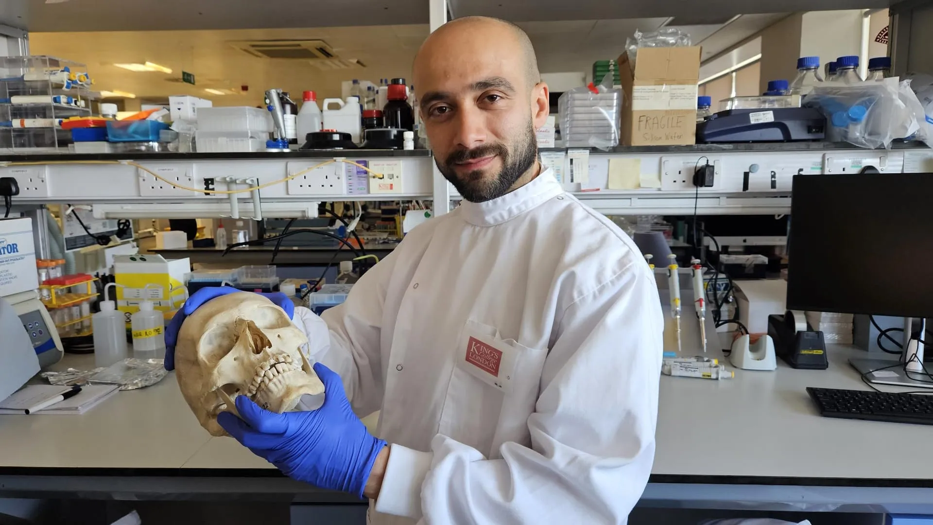 El investigador Sherif Elsharkawy sostiene un cráneo humano en una imagen asociada al estudio sobre membranas de queratina para reparar hueso.
