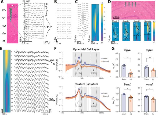 Registro y esquemas del hipocampo de ratas que muestran una disminución de ondas theta y gamma tras una lesión cerebral traumática experimental