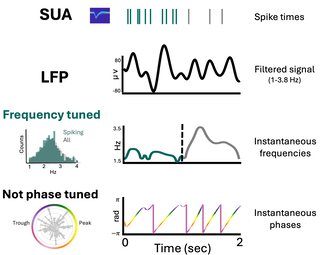 Esquema del estudio con ubicaciones de electrodos intracraneales y ejemplos de neuronas que disparan con distintas frecuencias de ondas cerebrales.