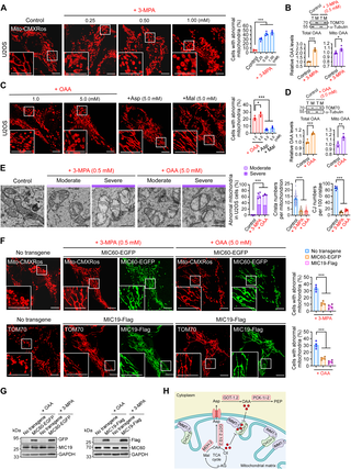 Figura del estudio que muestra alteraciones en la forma interna de las mitocondrias asociadas a la acumulación de oxaloacetato.