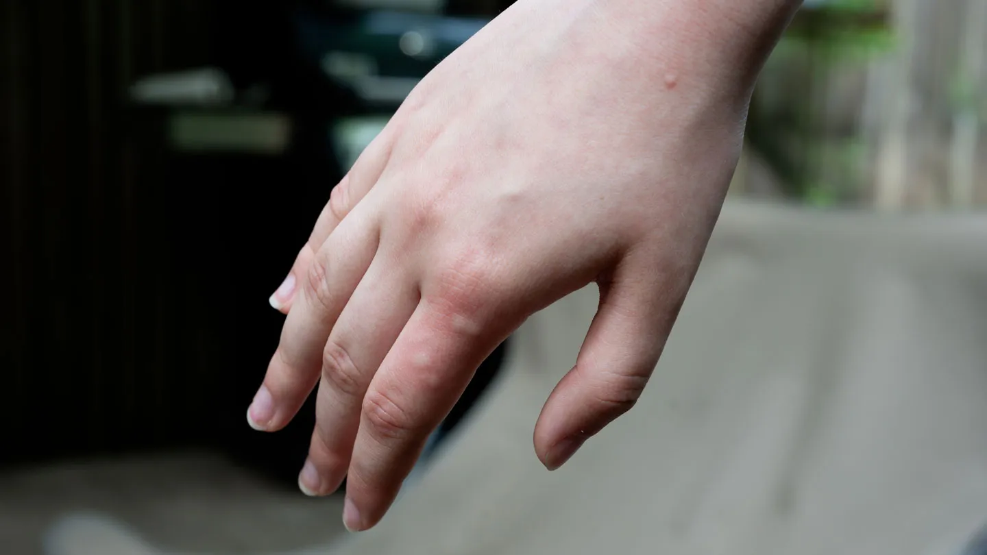 Brazo dentro de un dispositivo transparente usado para medir cuántos mosquitos se acercan al olor humano.