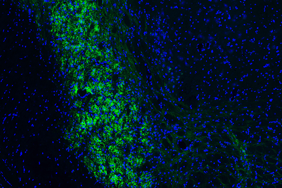 Microfotografía del tronco encefálico de un ratón coloreada para resaltar neuronas vinculadas al procesamiento táctil de los bigotes.