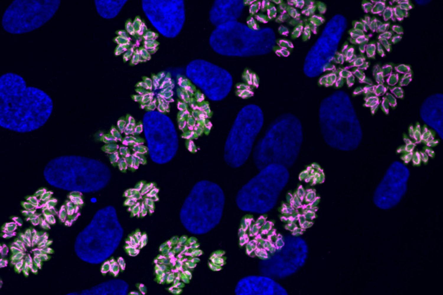 Micrografía de grupos del parásito Toxoplasma cerca de grandes estructuras azules dentro de una célula.