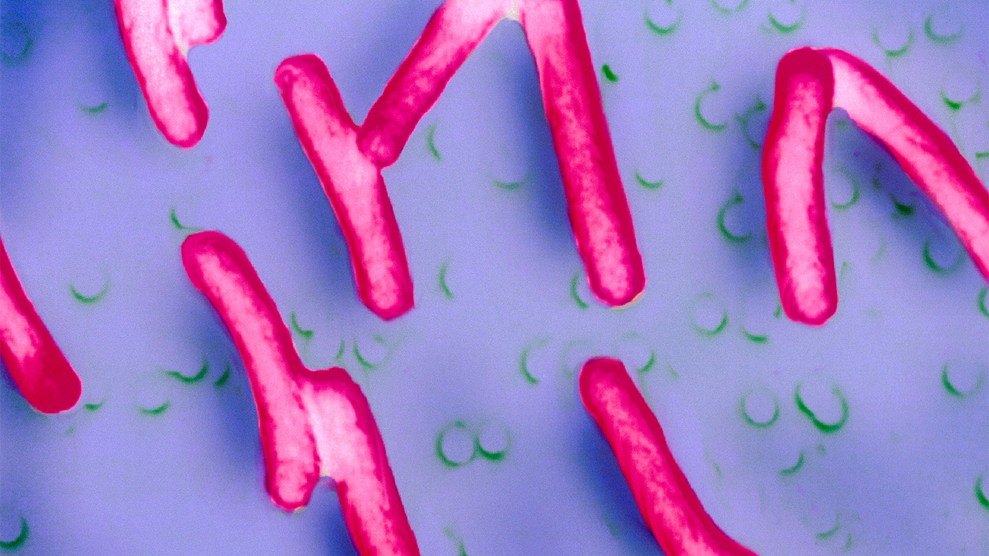 Ilustración conceptual sobre una vacuna oral contra Shigella y una infección intestinal